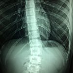 Crafting a Winning Cover Letter for Radiographers: Tips and Examples for Success